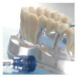 Implantat